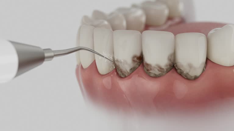 Trusted Teeth Cleaning And Checkup service in Connersville, IN - Dentist Open Now